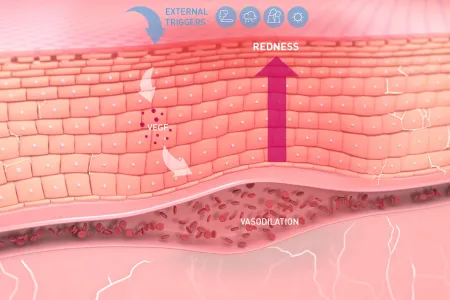 bioderma-sensibio-cilt görüntüsü