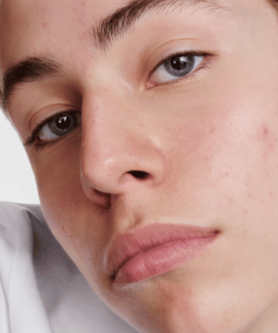 BIODERMA | Ekobiyolojiden Güç Alan Dermatoloji
    


    

            
       